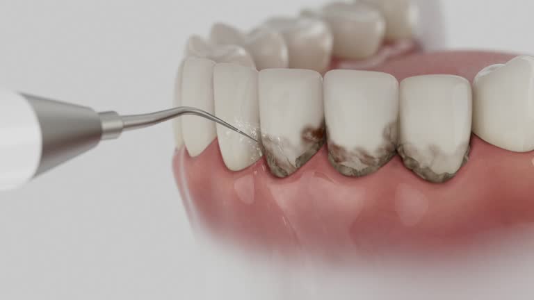 Reliable Teeth Cleaning And Checkup contractor in Grenada County County, MS by Dentist Open Now